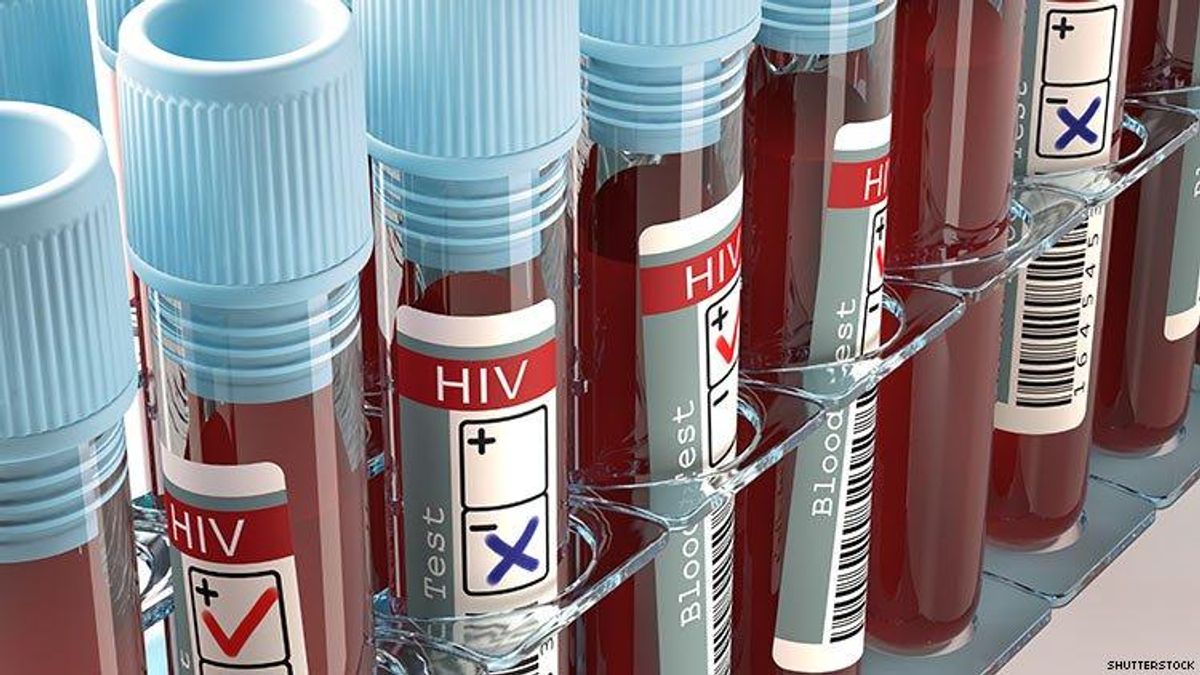 A Third Patient Is HIV-Free After Transplant