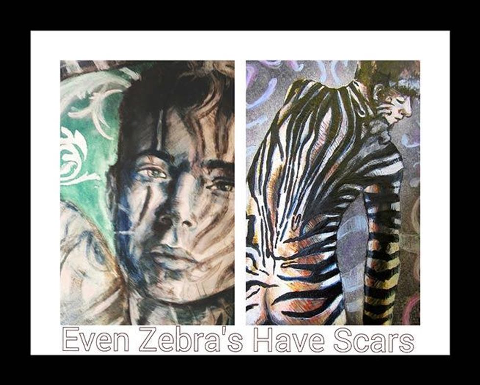 Even Zebras Have Scars