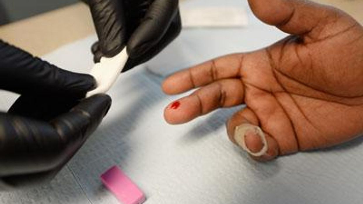 Hiv-blood-test-x400
