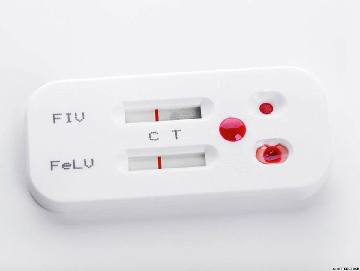HIV Self-Test Kits Are Met With Apprehension in Kenya