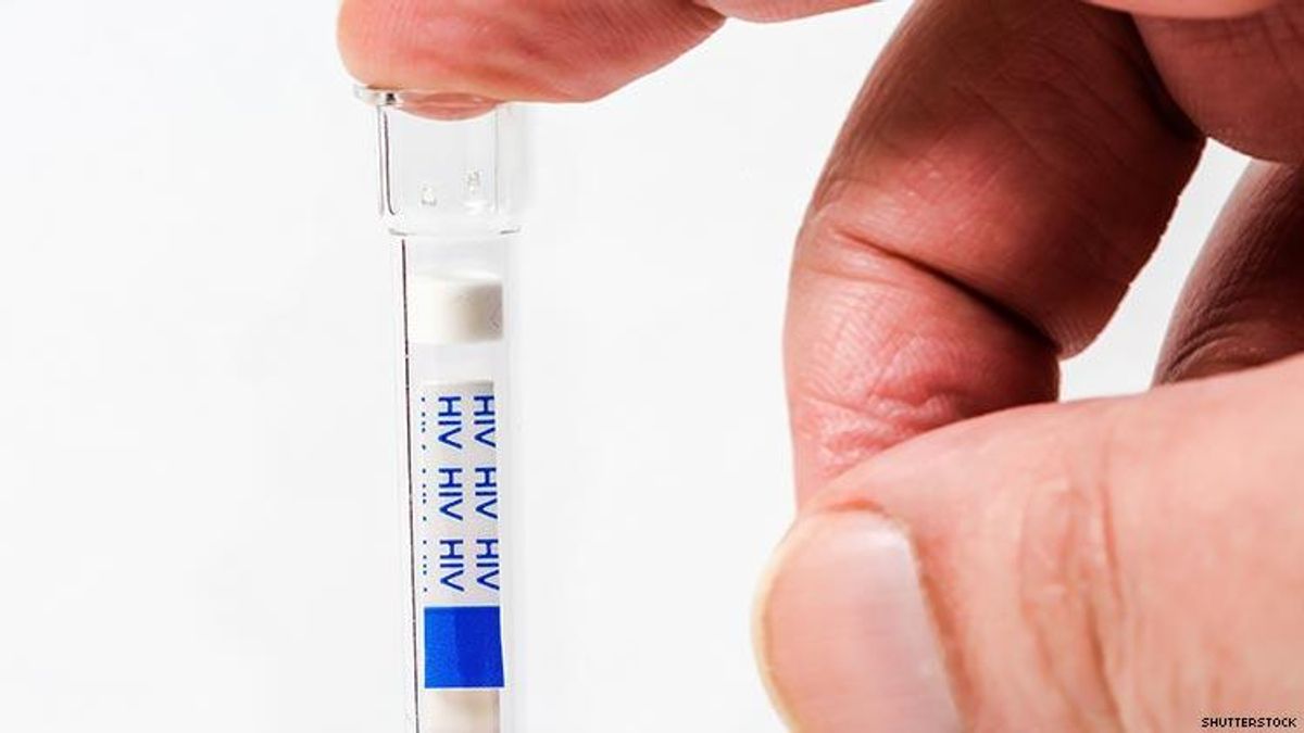HIV Self-Testing is the Preferred Testing Method in South Africa