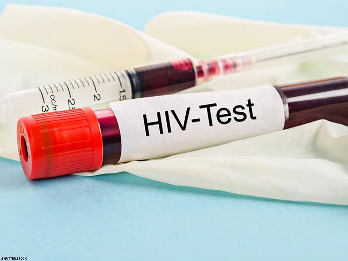 Is It Possible I Got a False Positive on My HIV Test