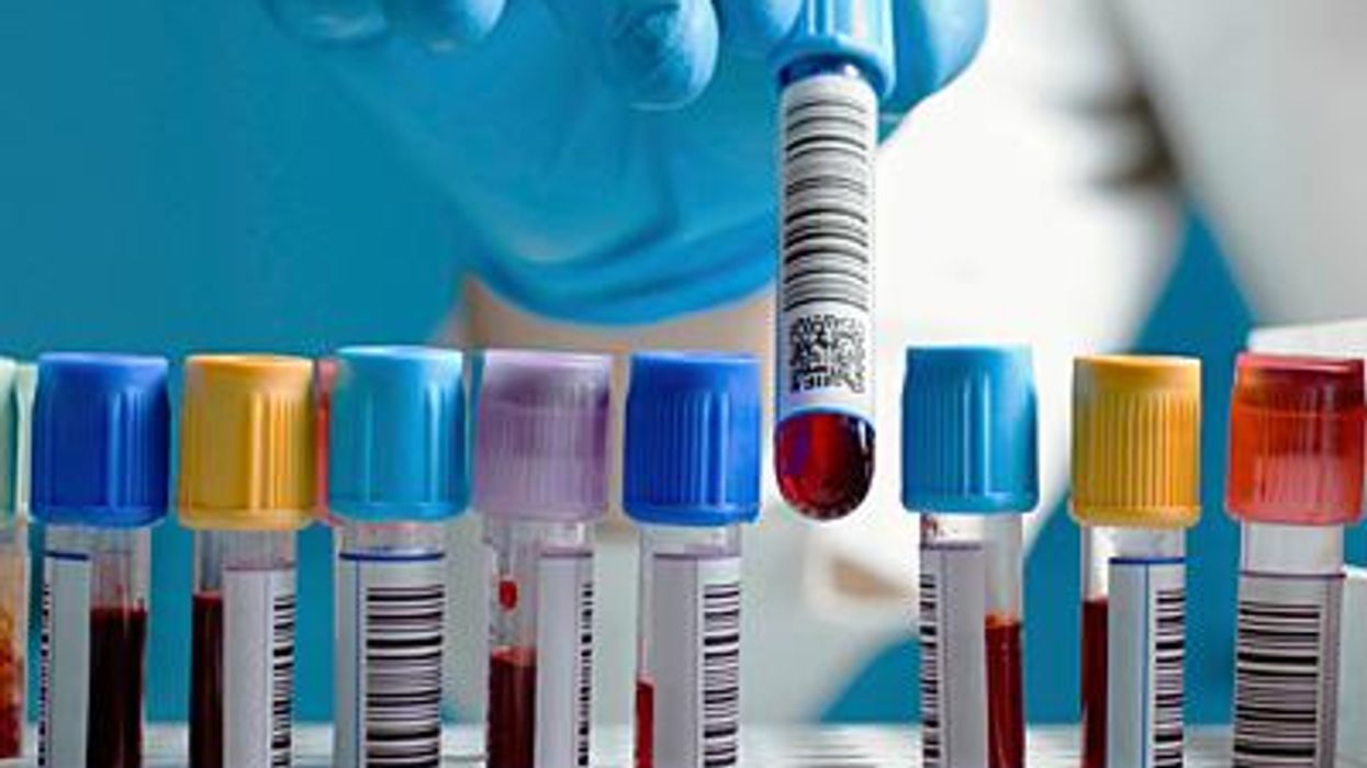 Lab_blood_samplesx400