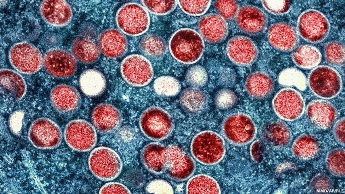 microscopic view of mpox virus