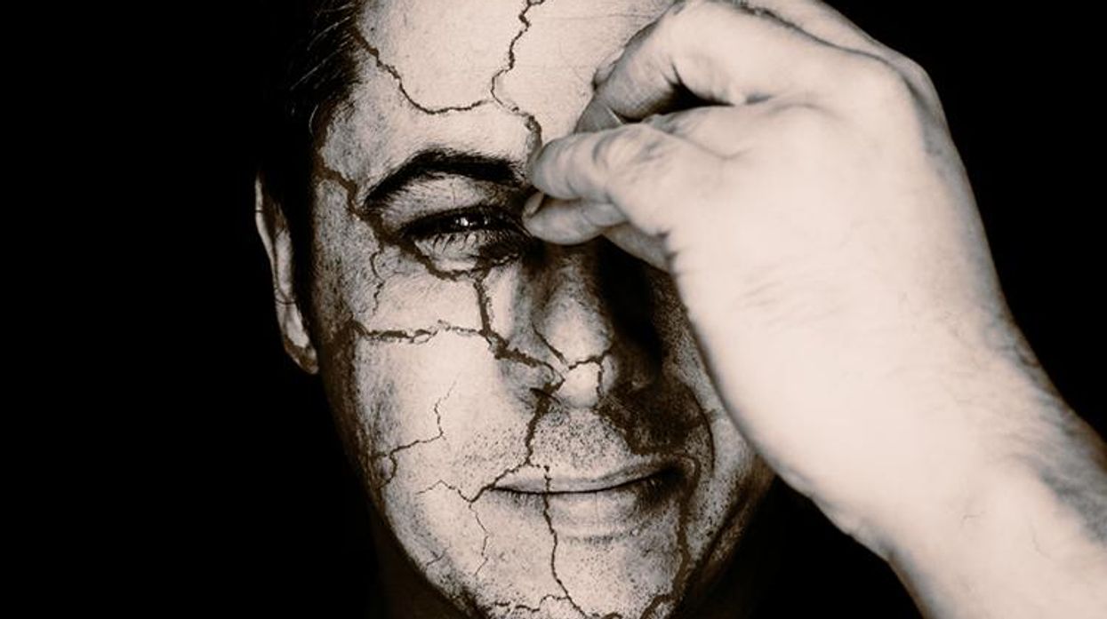 Q&A HIV Has Changed the Way I Look!