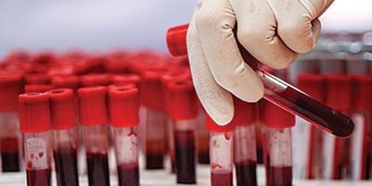 Just Diagnosed? Here's How to Understand All Those New Lab Tests