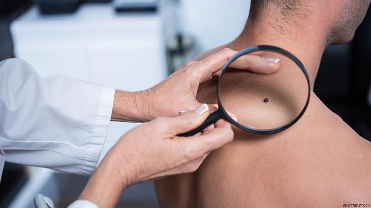 Skin Cancer HIV Connection