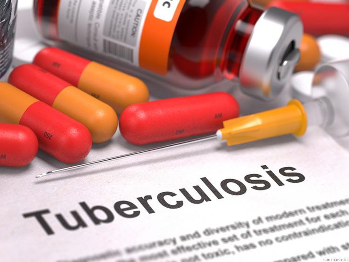 Spike in TB/HIV Cases on Alarms Health Officals in Europe