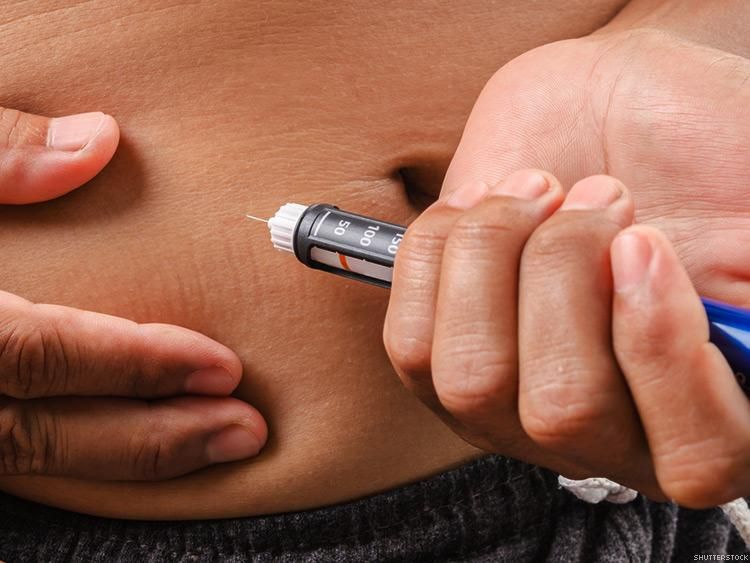 New Implants Show Promise in Treating Type 1 Diabetes